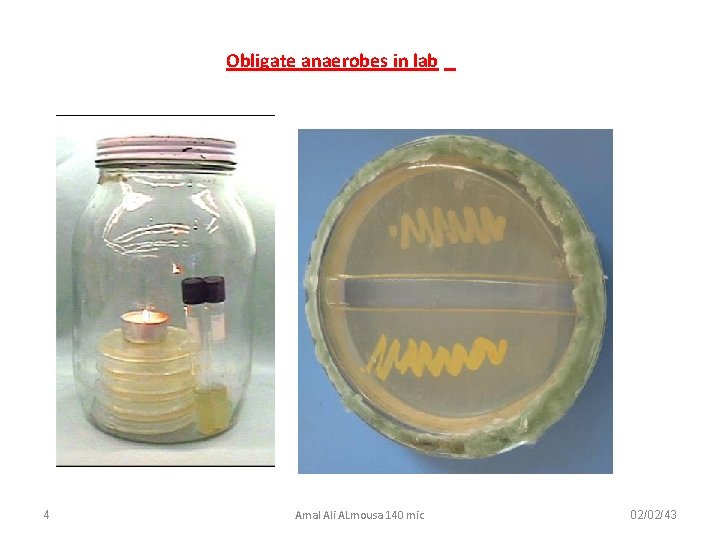 Obligate anaerobes in lab 4 Amal Ali ALmousa 140 mic 02/02/43 