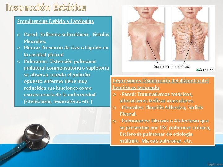 Inspección Estática Prominencias Debido a Patologías o Pared: Enfisema subcutáneo , Fístulas Pleurales. o