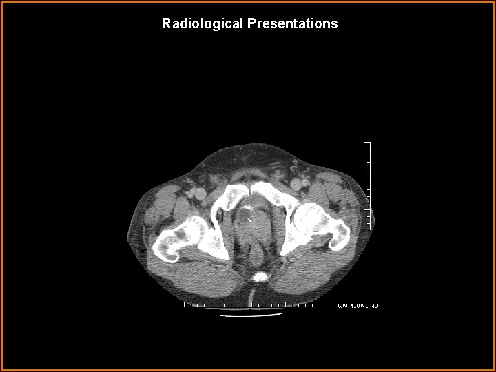 Radiological Presentations 