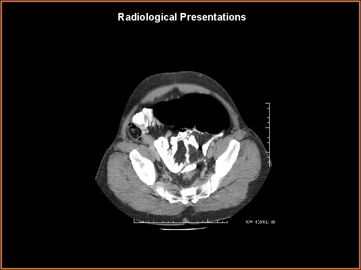 Radiological Presentations 