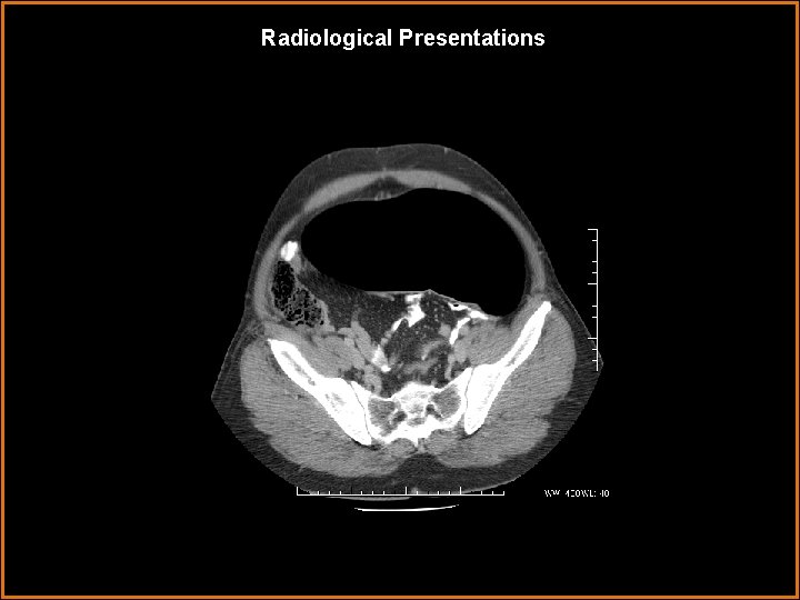 Radiological Presentations 