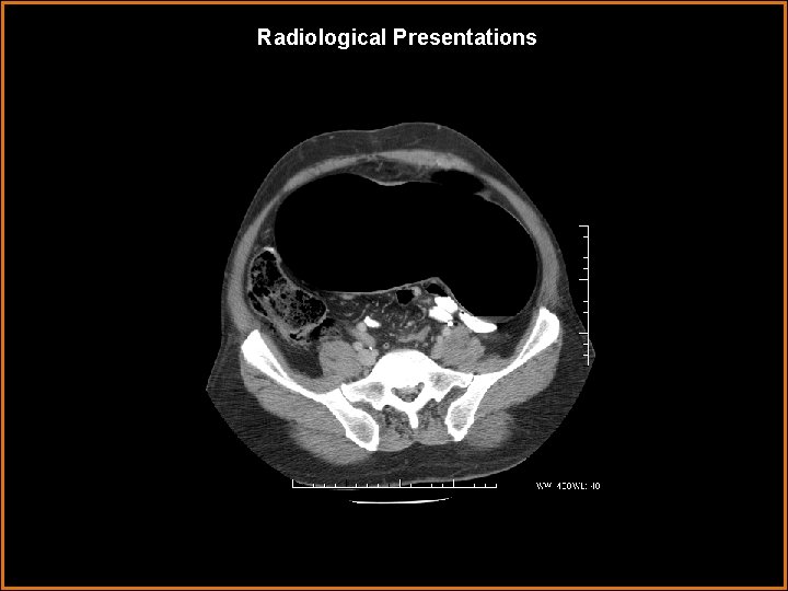 Radiological Presentations 