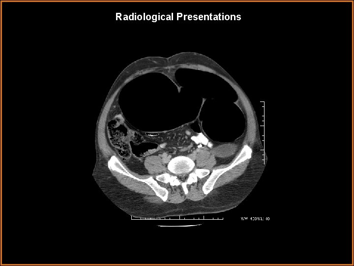 Radiological Presentations 