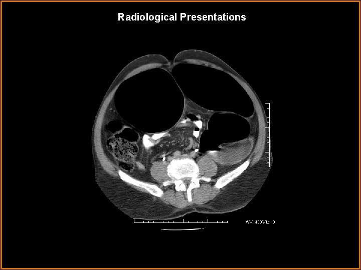 Radiological Presentations 