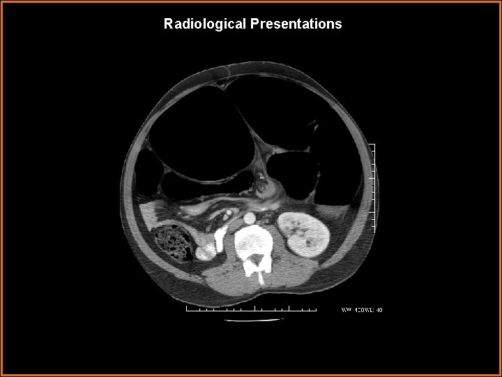 Radiological Presentations 