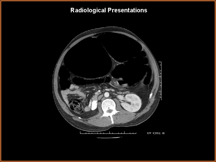 Radiological Presentations 