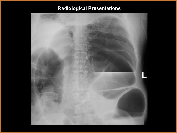 Radiological Presentations 