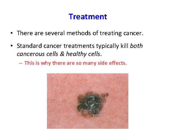 Treatment • There are several methods of treating cancer. • Standard cancer treatments typically