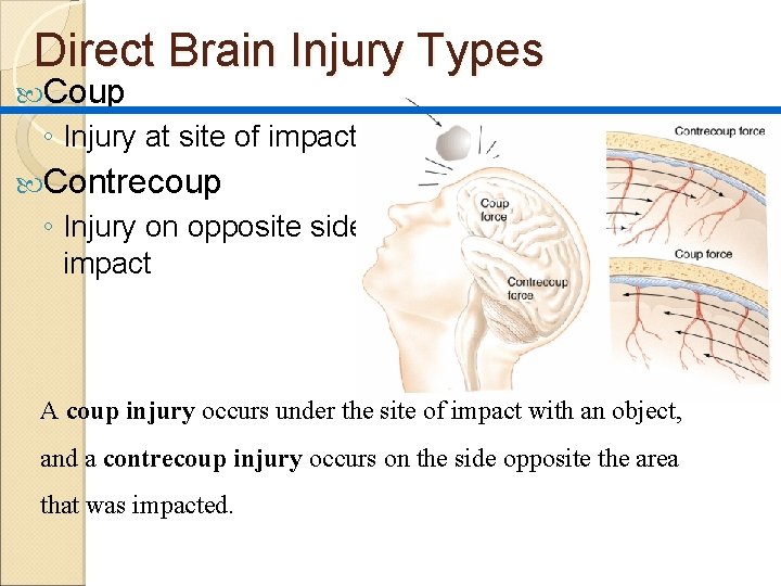 Direct Brain Injury Types Coup ◦ Injury at site of impact Contrecoup ◦ Injury