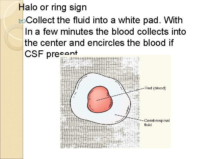 Halo or ring sign Collect the fluid into a white pad. With In a