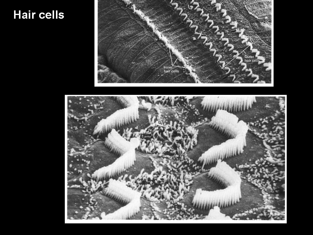 Hair cells 