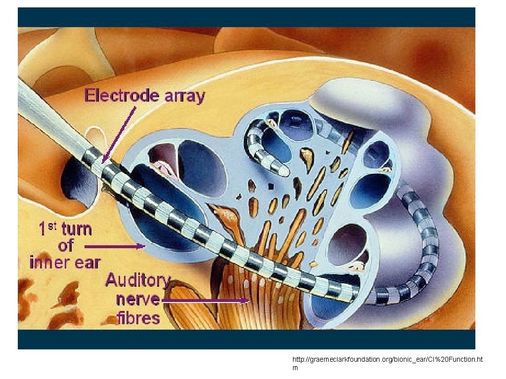 http: //graemeclarkfoundation. org/bionic_ear/CI%20 Function. ht m 