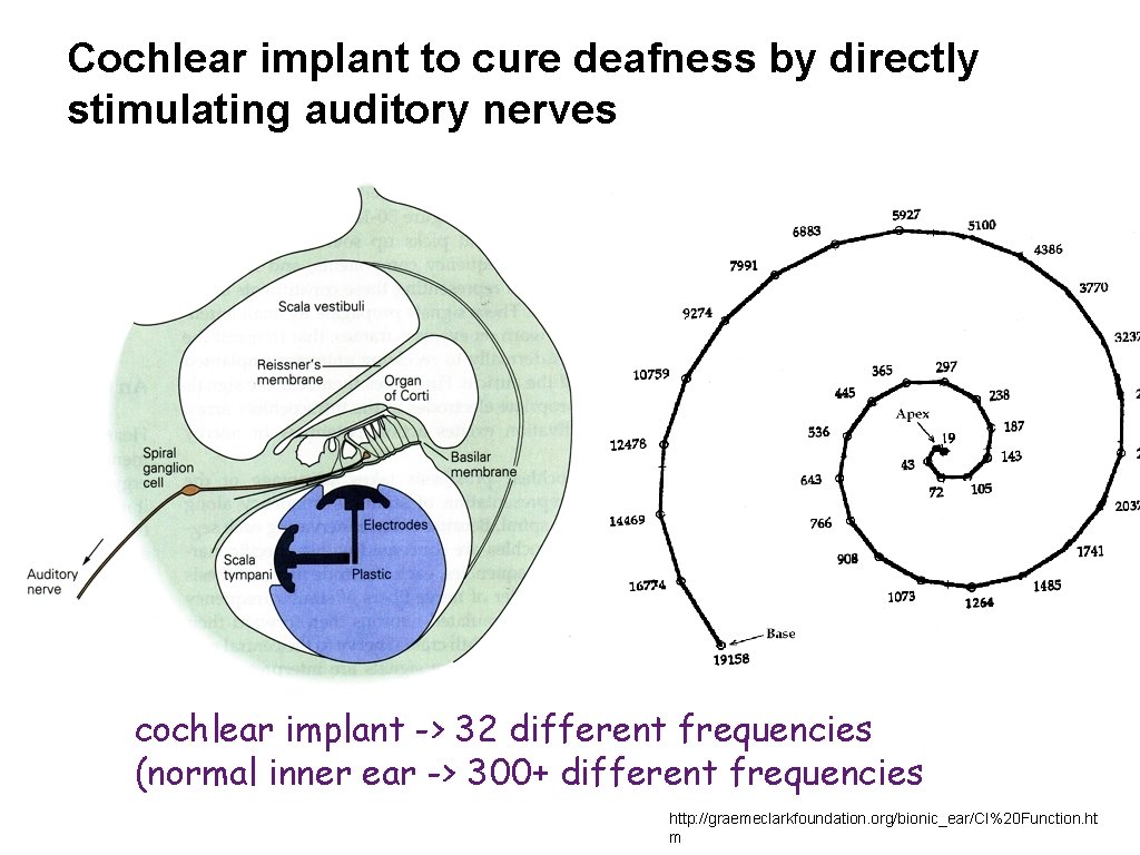 Cochlear implant to cure deafness by directly stimulating auditory nerves cochlear implant -> 32