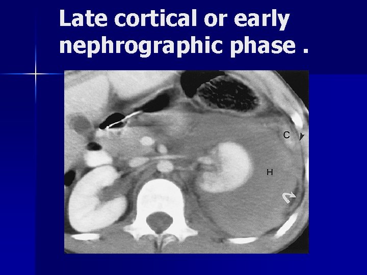 Late cortical or early nephrographic phase. 