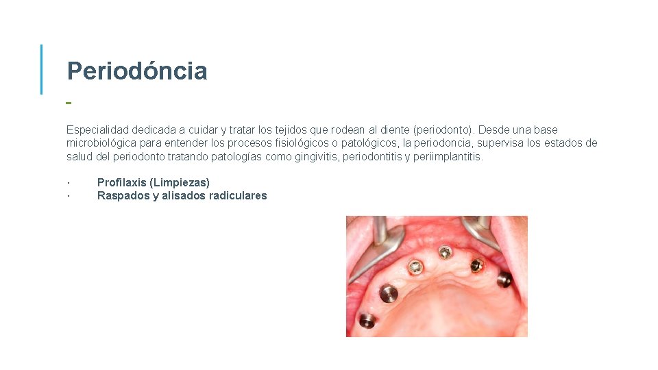 Periodóncia Especialidad dedicada a cuidar y tratar los tejidos que rodean al diente (periodonto).