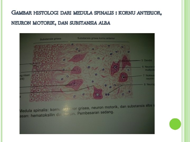 GAMBAR HISTOLOGI DARI MEDULA SPINALIS : KORNU ANTERIOR, NEURON MOTORIK, DAN SUBSTANSIA ALBA 