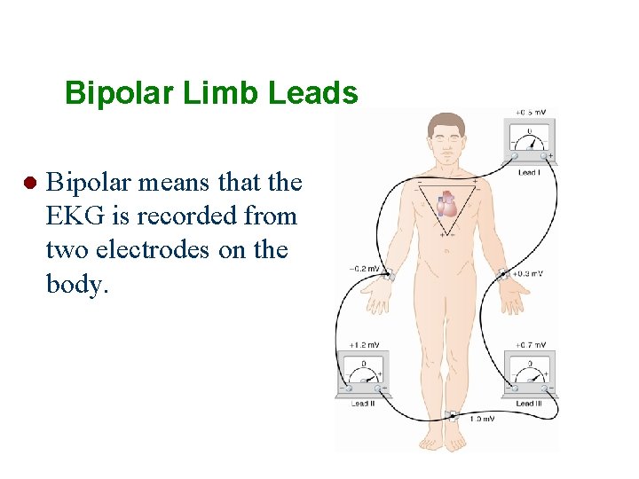 Bipolar Limb Leads l Bipolar means that the EKG is recorded from two electrodes