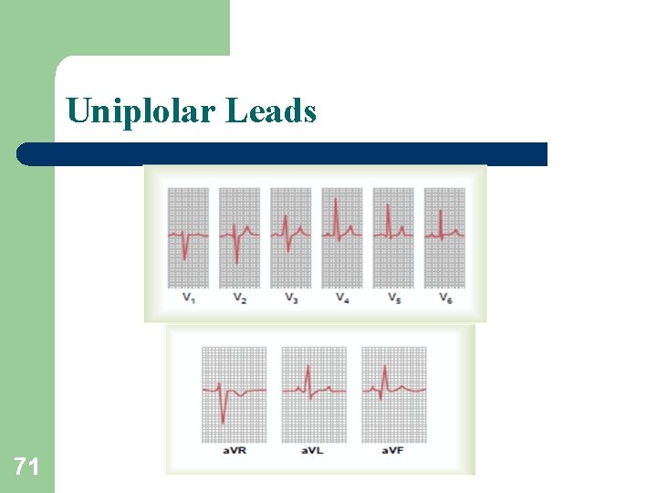 Uniplolar Leads 71 