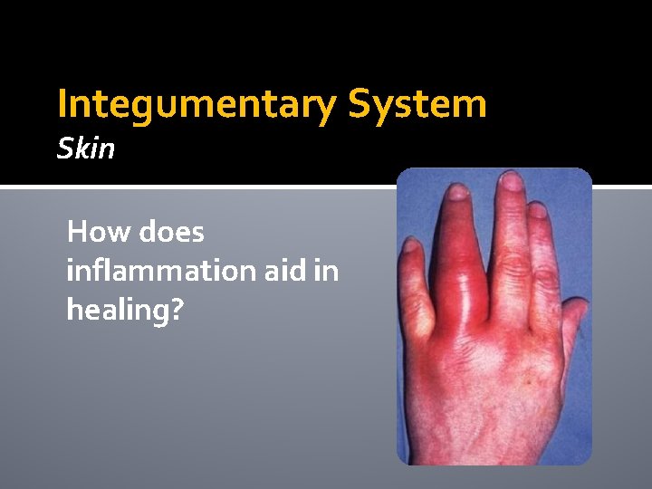 Integumentary System Skin How does inflammation aid in healing? Integumentary System Skin How does inflammation aid in healing?