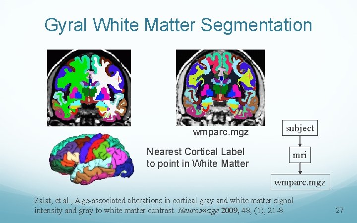 Gyral White Matter Segmentation + + wmparc. mgz Nearest Cortical Label to point in