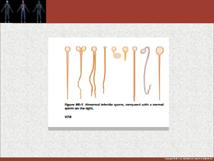 Copyright © 2011 by Saunders, an imprint of Elsevier Inc. 