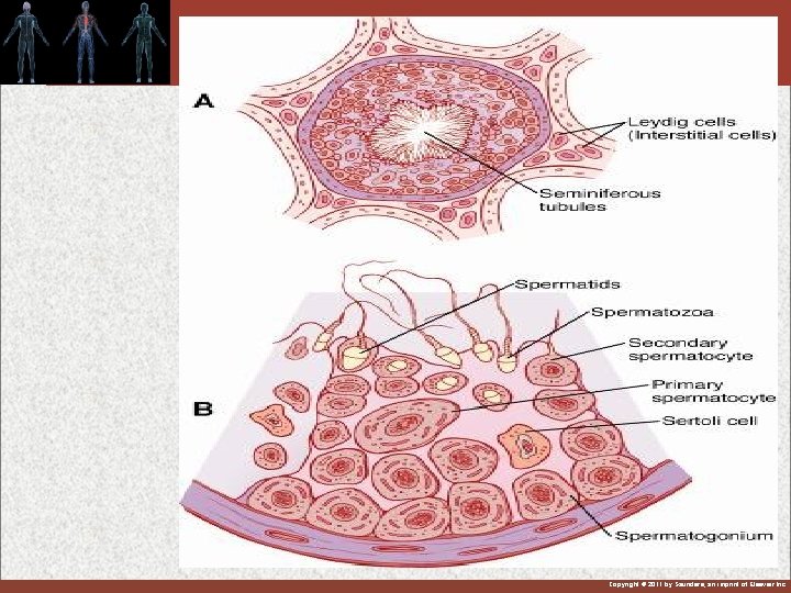 Figure 80 -2 Copyright © 2011 by Saunders, an imprint of Elsevier Inc. 