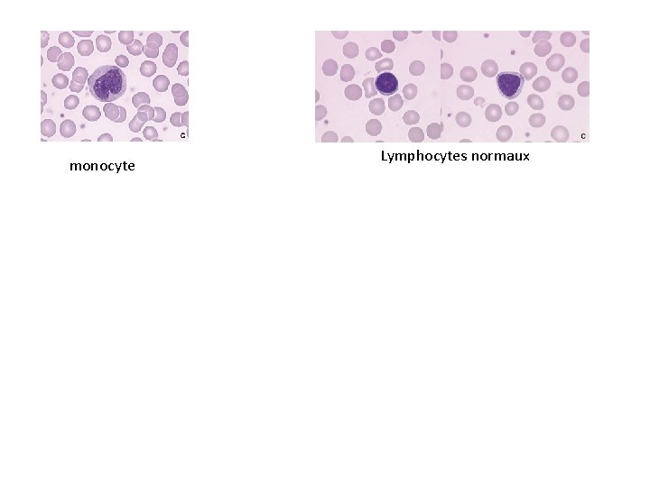 monocyte Lymphocytes normaux 
