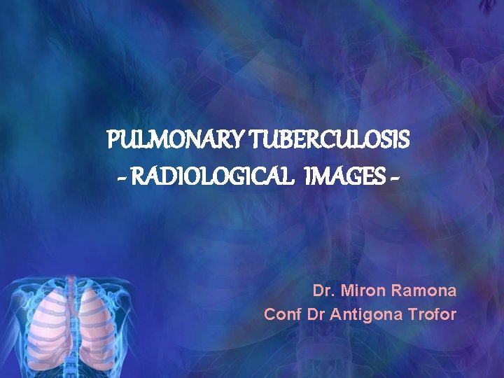 PULMONARY TUBERCULOSIS - RADIOLOGICAL IMAGES - Dr. Miron Ramona Conf Dr Antigona Trofor 