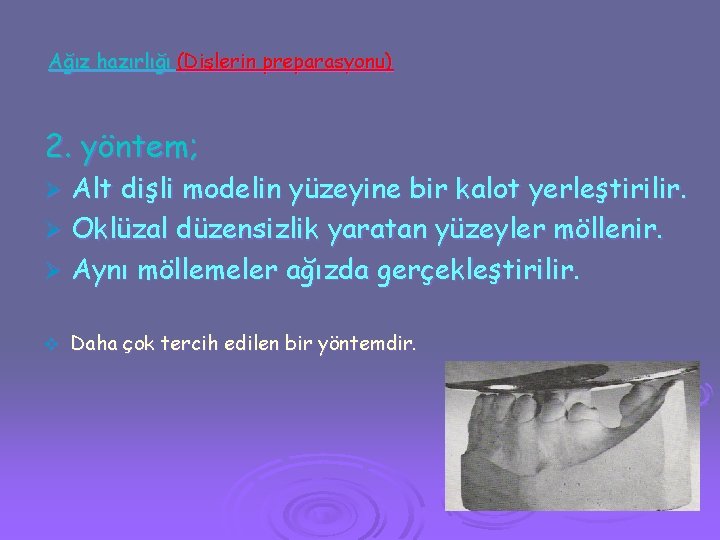 Ağız hazırlığı (Dişlerin preparasyonu) 2. yöntem; Alt dişli modelin yüzeyine bir kalot yerleştirilir. Ø