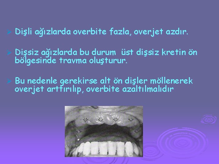 Ø Dişli ağızlarda overbite fazla, overjet azdır. Ø Dişsiz ağızlarda bu durum üst dişsiz