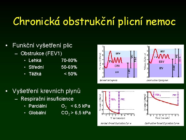 Chronická obstrukční plicní nemoc • Funkční vyšetření plic – Obstrukce (FEV 1) • Lehká