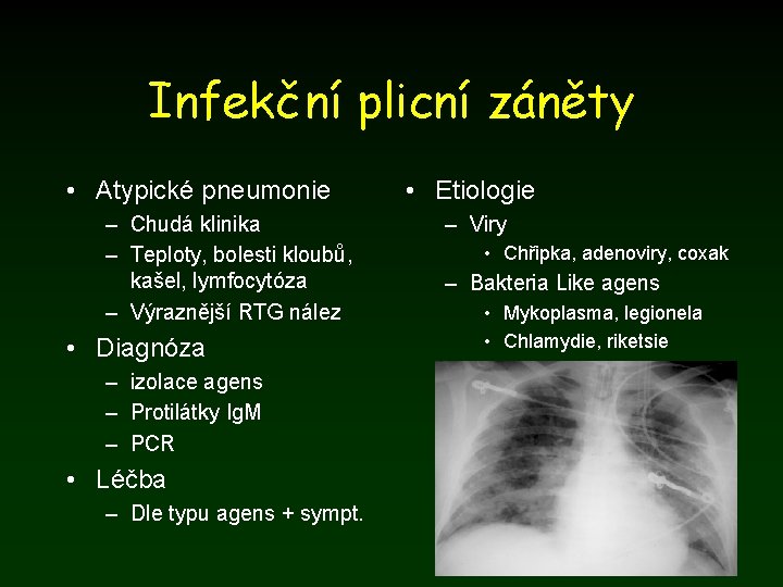 Infekční plicní záněty • Atypické pneumonie – Chudá klinika – Teploty, bolesti kloubů, kašel,