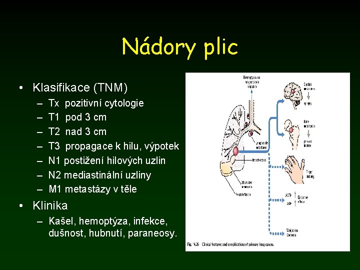 Nádory plic • Klasifikace (TNM) – – – – Tx pozitivní cytologie T 1