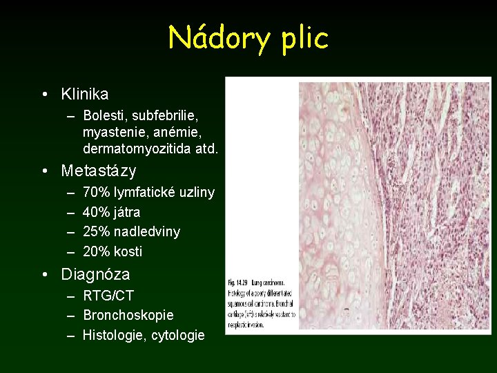 Nádory plic • Klinika – Bolesti, subfebrilie, myastenie, anémie, dermatomyozitida atd. • Metastázy –