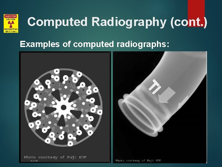 Computed Radiography (cont. ) Examples of computed radiographs: 
