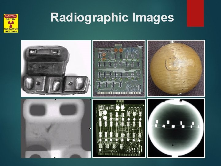 Radiographic Images 