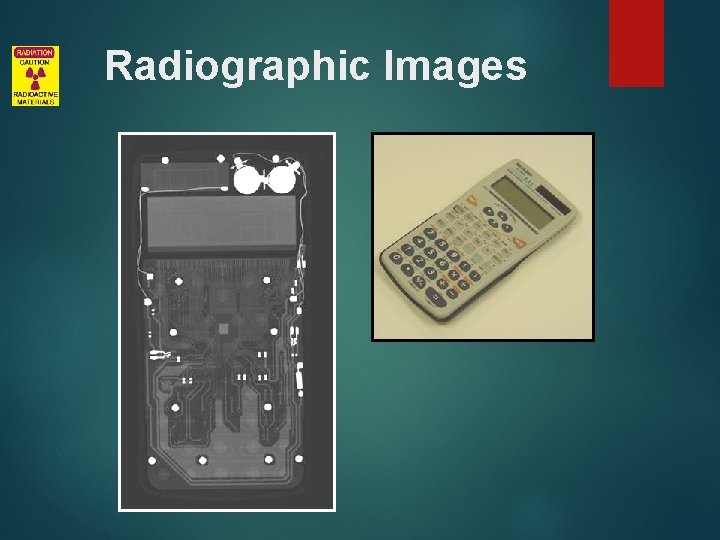 Radiographic Images 