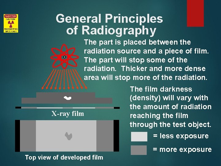 General Principles of Radiography The part is placed between the radiation source and a