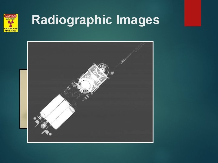 Radiographic Images 