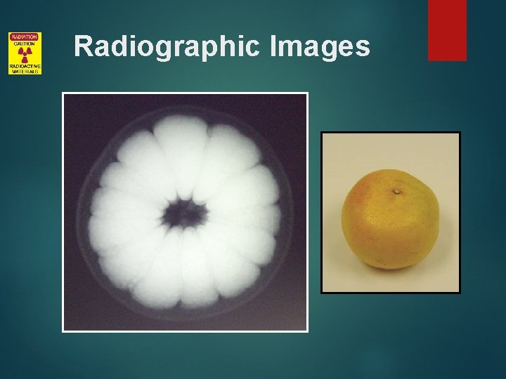 Radiographic Images 