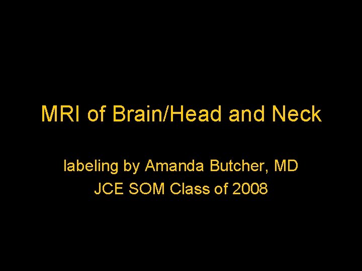 MRI of Brain/Head and Neck labeling by Amanda Butcher, MD JCE SOM Class of