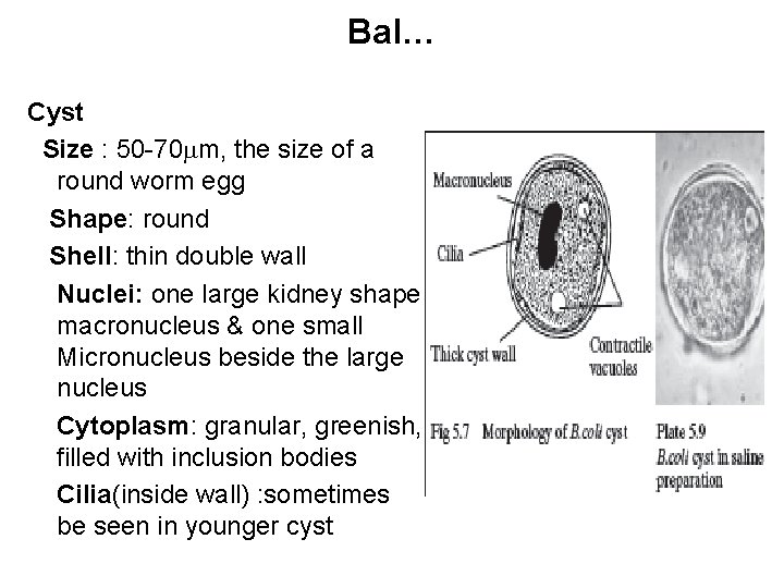 Bal… Cyst Size : 50 -70 m, the size of a round worm egg