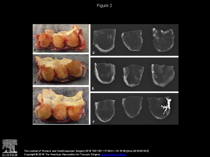 Figure 2 The Journal of Thoracic and Cardiovascular Surgery 2016 1521167 -1174 DOI: (10.