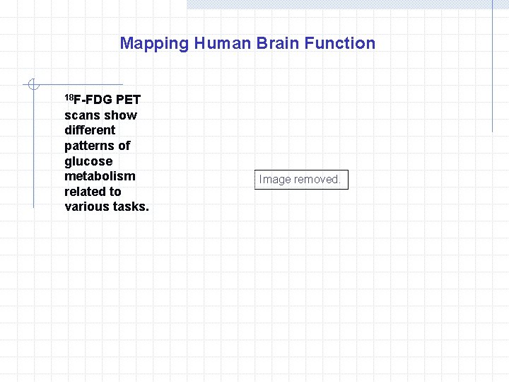 Mapping Human Brain Function 18 F-FDG PET scans show different patterns of glucose metabolism