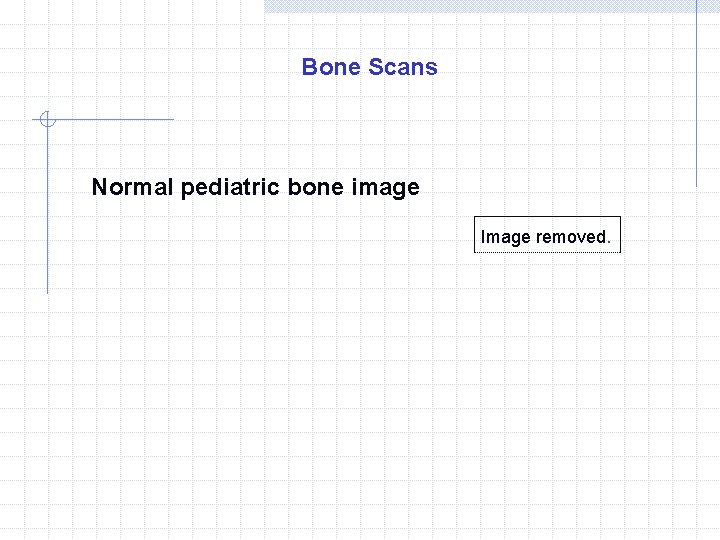 Bone Scans Normal pediatric bone image Image removed. 