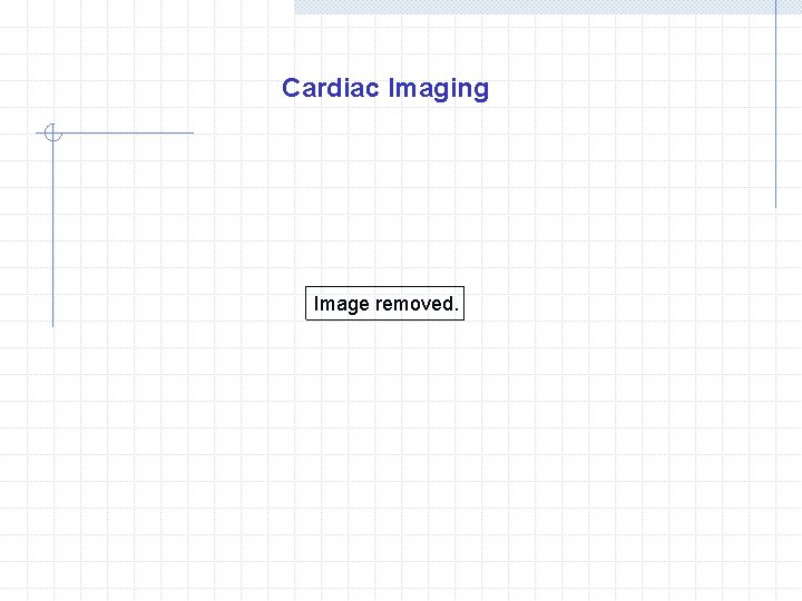 Cardiac Imaging Image removed. 