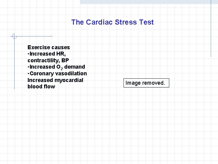 The Cardiac Stress Test Exercise causes • Increased HR, contractility, BP • Increased O