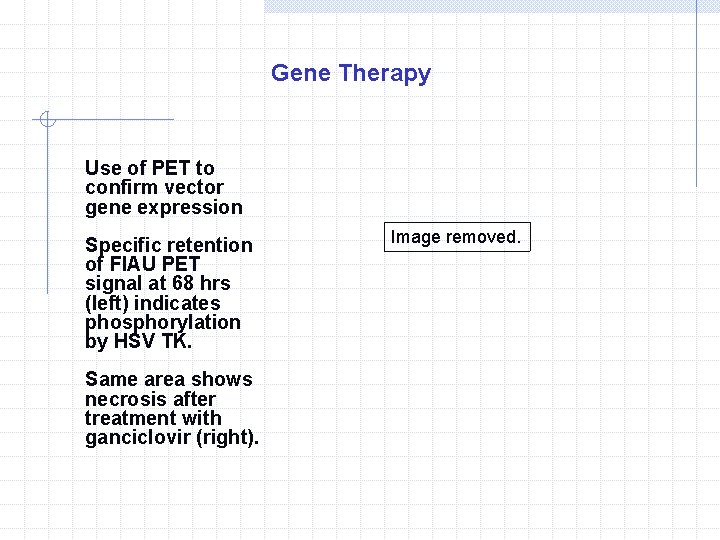 Gene Therapy Use of PET to confirm vector gene expression Specific retention of FIAU