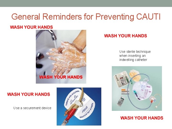 General Reminders for Preventing CAUTI Use sterile technique when inserting an indwelling catheter WASH