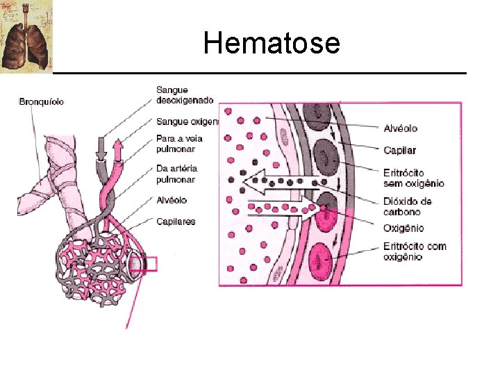 Hematose 